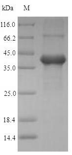 (Tris-Glycine gel) Discontinuous SDS-PAGE (reduced) with 5% enrichment gel and 15% separation gel. (Tris-Glycine gel) Discontinuous SDS-PAGE (reduced) with 5% enrichment gel and 15% separation gel.