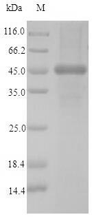 (Tris-Glycine gel) Discontinuous SDS-PAGE (reduced) with 5% enrichment gel and 15% separation gel. (Tris-Glycine gel) Discontinuous SDS-PAGE (reduced) with 5% enrichment gel and 15% separation gel.