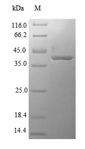 (Tris-Glycine gel) Discontinuous SDS-PAGE (reduced) with 5% enrichment gel and 15% separation gel.