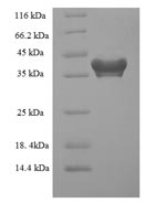 (Tris-Glycine gel) Discontinuous SDS-PAGE (reduced) with 5% enrichment gel and 15% separation gel. (Tris-Glycine gel) Discontinuous SDS-PAGE (reduced) with 5% enrichment gel and 15% separation gel.