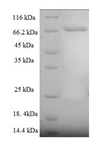 (Tris-Glycine gel) Discontinuous SDS-PAGE (reduced) with 5% enrichment gel and 15% separation gel. (Tris-Glycine gel) Discontinuous SDS-PAGE (reduced) with 5% enrichment gel and 15% separation gel.