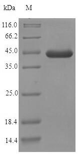 (Tris-Glycine gel) Discontinuous SDS-PAGE (reduced) with 5% enrichment gel and 15% separation gel. (Tris-Glycine gel) Discontinuous SDS-PAGE (reduced) with 5% enrichment gel and 15% separation gel.