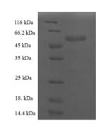 (Tris-Glycine gel) Discontinuous SDS-PAGE (reduced) with 5% enrichment gel and 15% separation gel. (Tris-Glycine gel) Discontinuous SDS-PAGE (reduced) with 5% enrichment gel and 15% separation gel.