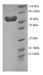 (Tris-Glycine gel) Discontinuous SDS-PAGE (reduced) with 5% enrichment gel and 15% separation gel. (Tris-Glycine gel) Discontinuous SDS-PAGE (reduced) with 5% enrichment gel and 15% separation gel.