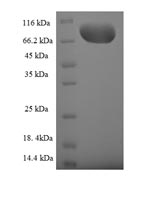 (Tris-Glycine gel) Discontinuous SDS-PAGE (reduced) with 5% enrichment gel and 15% separation gel. (Tris-Glycine gel) Discontinuous SDS-PAGE (reduced) with 5% enrichment gel and 15% separation gel.