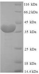 (Tris-Glycine gel) Discontinuous SDS-PAGE (reduced) with 5% enrichment gel and 15% separation gel. (Tris-Glycine gel) Discontinuous SDS-PAGE (reduced) with 5% enrichment gel and 15% separation gel.