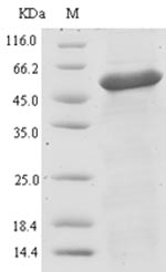 (Tris-Glycine gel) Discontinuous SDS-PAGE (reduced) with 5% enrichment gel and 15% separation gel. (Tris-Glycine gel) Discontinuous SDS-PAGE (reduced) with 5% enrichment gel and 15% separation gel.