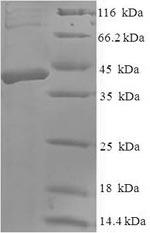 SDS-PAGE- Recombinant protein Human DKK2
