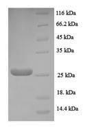 SDS-PAGE- Recombinant protein Human NRN1