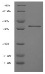 (Tris-Glycine gel) Discontinuous SDS-PAGE (reduced) with 5% enrichment gel and 15% separation gel. (Tris-Glycine gel) Discontinuous SDS-PAGE (reduced) with 5% enrichment gel and 15% separation gel.