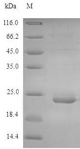 (Tris-Glycine gel) Discontinuous SDS-PAGE (reduced) with 5% enrichment gel and 15% separation gel. (Tris-Glycine gel) Discontinuous SDS-PAGE (reduced) with 5% enrichment gel and 15% separation gel.