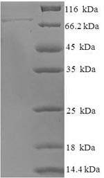 (Tris-Glycine gel) Discontinuous SDS-PAGE (reduced) with 5% enrichment gel and 15% separation gel. (Tris-Glycine gel) Discontinuous SDS-PAGE (reduced) with 5% enrichment gel and 15% separation gel.
