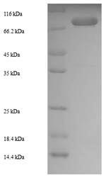 (Tris-Glycine gel) Discontinuous SDS-PAGE (reduced) with 5% enrichment gel and 15% separation gel. (Tris-Glycine gel) Discontinuous SDS-PAGE (reduced) with 5% enrichment gel and 15% separation gel.