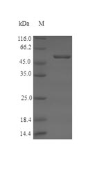 (Tris-Glycine gel) Discontinuous SDS-PAGE (reduced) with 5% enrichment gel and 15% separation gel.