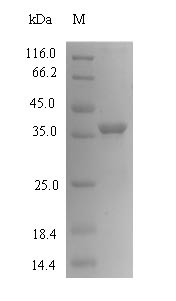 (Tris-Glycine gel) Discontinuous SDS-PAGE (reduced) with 5% enrichment gel and 15% separation gel. (Tris-Glycine gel) Discontinuous SDS-PAGE (reduced) with 5% enrichment gel and 15% separation gel.