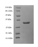 SDS-PAGE- Recombinant protein Arabidopsis WRKY2