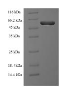 (Tris-Glycine gel) Discontinuous SDS-PAGE (reduced) with 5% enrichment gel and 15% separation gel. (Tris-Glycine gel) Discontinuous SDS-PAGE (reduced) with 5% enrichment gel and 15% separation gel.