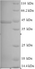 (Tris-Glycine gel) Discontinuous SDS-PAGE (reduced) with 5% enrichment gel and 15% separation gel.