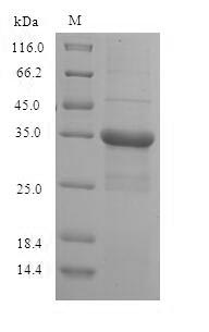 (Tris-Glycine gel) Discontinuous SDS-PAGE (reduced) with 5% enrichment gel and 15% separation gel. (Tris-Glycine gel) Discontinuous SDS-PAGE (reduced) with 5% enrichment gel and 15% separation gel.