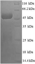 (Tris-Glycine gel) Discontinuous SDS-PAGE (reduced) with 5% enrichment gel and 15% separation gel.