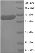 SDS-PAGE- Recombinant protein Human METTL11A