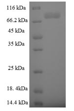 (Tris-Glycine gel) Discontinuous SDS-PAGE (reduced) with 5% enrichment gel and 15% separation gel. (Tris-Glycine gel) Discontinuous SDS-PAGE (reduced) with 5% enrichment gel and 15% separation gel.
