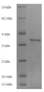 (Tris-Glycine gel) Discontinuous SDS-PAGE (reduced) with 5% enrichment gel and 15% separation gel. (Tris-Glycine gel) Discontinuous SDS-PAGE (reduced) with 5% enrichment gel and 15% separation gel.