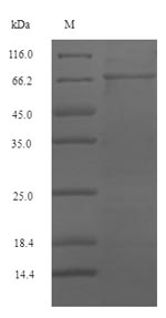 (Tris-Glycine gel) Discontinuous SDS-PAGE (reduced) with 5% enrichment gel and 15% separation gel. (Tris-Glycine gel) Discontinuous SDS-PAGE (reduced) with 5% enrichment gel and 15% separation gel.