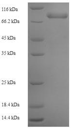 (Tris-Glycine gel) Discontinuous SDS-PAGE (reduced) with 5% enrichment gel and 15% separation gel. (Tris-Glycine gel) Discontinuous SDS-PAGE (reduced) with 5% enrichment gel and 15% separation gel.