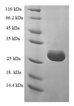 (Tris-Glycine gel) Discontinuous SDS-PAGE (reduced) with 5% enrichment gel and 15% separation gel. (Tris-Glycine gel) Discontinuous SDS-PAGE (reduced) with 5% enrichment gel and 15% separation gel.