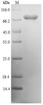 (Tris-Glycine gel) Discontinuous SDS-PAGE (reduced) with 5% enrichment gel and 15% separation gel. (Tris-Glycine gel) Discontinuous SDS-PAGE (reduced) with 5% enrichment gel and 15% separation gel.
