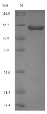 (Tris-Glycine gel) Discontinuous SDS-PAGE (reduced) with 5% enrichment gel and 15% separation gel. (Tris-Glycine gel) Discontinuous SDS-PAGE (reduced) with 5% enrichment gel and 15% separation gel.