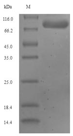 (Tris-Glycine gel) Discontinuous SDS-PAGE (reduced) with 5% enrichment gel and 15% separation gel. (Tris-Glycine gel) Discontinuous SDS-PAGE (reduced) with 5% enrichment gel and 15% separation gel.
