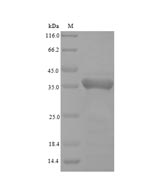 (Tris-Glycine gel) Discontinuous SDS-PAGE (reduced) with 5% enrichment gel and 15% separation gel.
