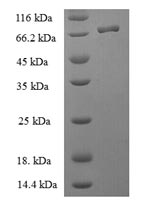 (Tris-Glycine gel) Discontinuous SDS-PAGE (reduced) with 5% enrichment gel and 15% separation gel. (Tris-Glycine gel) Discontinuous SDS-PAGE (reduced) with 5% enrichment gel and 15% separation gel.
