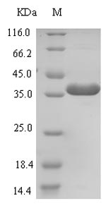 SDS-PAGE- Recombinant protein Human ZNRF3