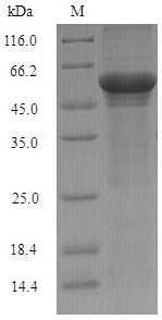 (Tris-Glycine gel) Discontinuous SDS-PAGE (reduced) with 5% enrichment gel and 15% separation gel. (Tris-Glycine gel) Discontinuous SDS-PAGE (reduced) with 5% enrichment gel and 15% separation gel.