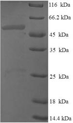 (Tris-Glycine gel) Discontinuous SDS-PAGE (reduced) with 5% enrichment gel and 15% separation gel. (Tris-Glycine gel) Discontinuous SDS-PAGE (reduced) with 5% enrichment gel and 15% separation gel.
