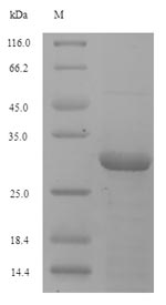 (Tris-Glycine gel) Discontinuous SDS-PAGE (reduced) with 5% enrichment gel and 15% separation gel. (Tris-Glycine gel) Discontinuous SDS-PAGE (reduced) with 5% enrichment gel and 15% separation gel.