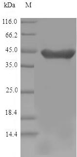 (Tris-Glycine gel) Discontinuous SDS-PAGE (reduced) with 5% enrichment gel and 15% separation gel. (Tris-Glycine gel) Discontinuous SDS-PAGE (reduced) with 5% enrichment gel and 15% separation gel.