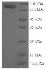 (Tris-Glycine gel) Discontinuous SDS-PAGE (reduced) with 5% enrichment gel and 15% separation gel. (Tris-Glycine gel) Discontinuous SDS-PAGE (reduced) with 5% enrichment gel and 15% separation gel.