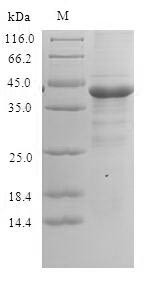 (Tris-Glycine gel) Discontinuous SDS-PAGE (reduced) with 5% enrichment gel and 15% separation gel. (Tris-Glycine gel) Discontinuous SDS-PAGE (reduced) with 5% enrichment gel and 15% separation gel.