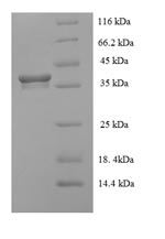 (Tris-Glycine gel) Discontinuous SDS-PAGE (reduced) with 5% enrichment gel and 15% separation gel. (Tris-Glycine gel) Discontinuous SDS-PAGE (reduced) with 5% enrichment gel and 15% separation gel.