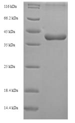 (Tris-Glycine gel) Discontinuous SDS-PAGE (reduced) with 5% enrichment gel and 15% separation gel. (Tris-Glycine gel) Discontinuous SDS-PAGE (reduced) with 5% enrichment gel and 15% separation gel.
