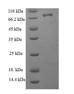 SDS-PAGE- Recombinant protein Human NOP58