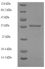 (Tris-Glycine gel) Discontinuous SDS-PAGE (reduced) with 5% enrichment gel and 15% separation gel. (Tris-Glycine gel) Discontinuous SDS-PAGE (reduced) with 5% enrichment gel and 15% separation gel.