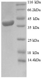 (Tris-Glycine gel) Discontinuous SDS-PAGE (reduced) with 5% enrichment gel and 15% separation gel.