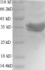 (Tris-Glycine gel) Discontinuous SDS-PAGE (reduced) with 5% enrichment gel and 15% separation gel. (Tris-Glycine gel) Discontinuous SDS-PAGE (reduced) with 5% enrichment gel and 15% separation gel.