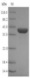 SDS-PAGE- Recombinant protein Hepatitis ORF2