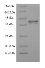 (Tris-Glycine gel) Discontinuous SDS-PAGE (reduced) with 5% enrichment gel and 15% separation gel. (Tris-Glycine gel) Discontinuous SDS-PAGE (reduced) with 5% enrichment gel and 15% separation gel.